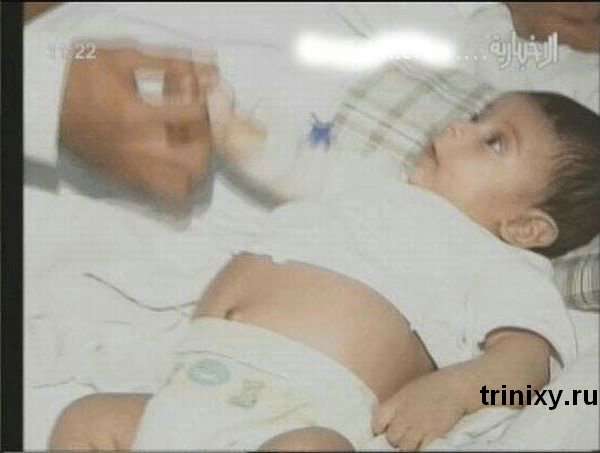 У Саудівській Аравії народилася вагітна дівчинка (6 фото)